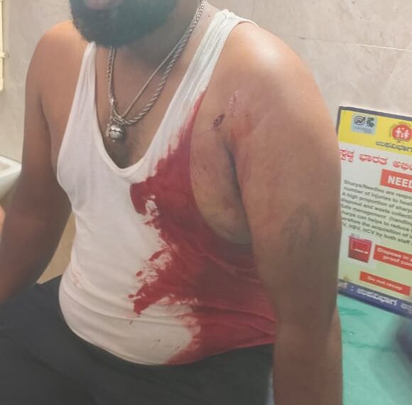 ಕೊಳ್ಳೇಗಾಲ – ಕಾಂಗ್ರೆಸ್ ಯುವ ಮುಖಂಡನಿಗೆ ಚಾಕು ಇರಿತ